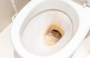 Comment nettoyer et eliminer le calcaire des WC